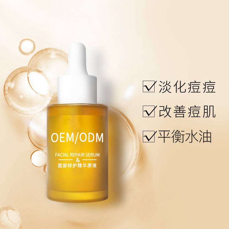牡丹江市_祛痘精华原液OEM